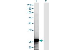 Western Blot analysis of NOL3 expression in transfected 293T cell line by NOL3 monoclonal antibody (M03A), clone 6F5. (NOL3 抗体  (AA 1-208))