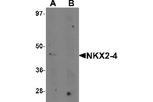 Western blot analysis of NKX2-4 in A20 cell lysate with NKX2-4 antibody at 1 µg/mL in (A) the absence and (B) the presence of blocking peptide. (NK2 Homeobox 4 抗体  (Middle Region))