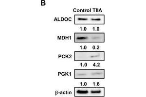Treatment with TIIA changes the expression of glucose metabolism-related proteins in AGS cells. (ALDOC 抗体)