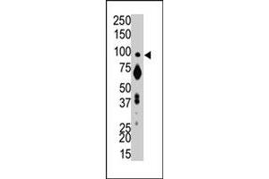The PTPRA polyclonal antibody  is used in Western blot to detect PTPRA in mouse brain tissue lysate.
