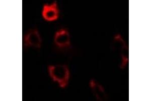 Immunofluorescence (IF) image for anti-Protein Disulfide Isomerase Family A, Member 6 (PDIA6) antibody (ABIN7306918)