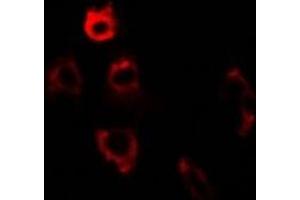 Immunofluorescent analysis of ERp5 staining in U2OS cells. (PDIA6 抗体)