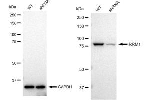 Western blotting analysis using RRM1 antibody (ABIN7800212).