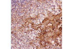 Anti-Annexin A1 Picoband antibody,  IHC(P): Human Tonsil Tissue (Annexin a1 抗体  (AA 2-346))