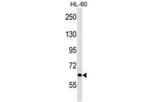 ANKHD1 Antibody (N-term) western blot analysis in HL-60 cell line lysates (35µg/lane). (ANKHD1 抗体  (N-Term))