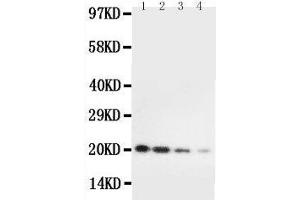 Anti-mouse IL10 antibody, Western blotting Lane 1: Recombinant Mouse IL10 Protein 10ng Lane 2: Recombinant Mouse IL10 Protein 5ng Lane 3: Recombinant Mouse IL10 Protein 2 (IL-10 抗体  (AA 19-178))
