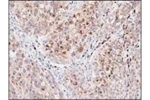 Immunohistochemistry (IHC) image for anti-Melanosome (C-Term) antibody (ABIN870422) (Melanosome (C-Term) 抗体)
