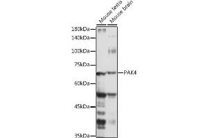 Western blot analysis of extracts of various cell lines, using P antibody (ABIN6130472, ABIN6145188, ABIN6145189 and ABIN6215336) at 1:1000 dilution. (PAK4 抗体  (AA 120-280))