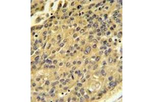 Image no. 1 for anti-Cathepsin H (CTSH) (AA 32-62), (N-Term) antibody (ABIN452890) (Cathepsin H 抗体  (N-Term))