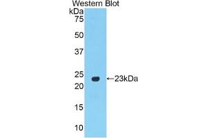 Detection of Recombinant PPARg, Rat using Polyclonal Antibody to Peroxisome Proliferator Activated Receptor Gamma (PPARg) (PPARG 抗体  (AA 311-493))