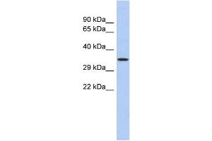 WB Suggested Anti-PRDM12 Antibody Titration: 0. (PRDM12 抗体  (N-Term))