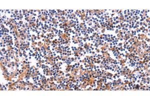 Immunohistochemistry of paraffin-embedded Human tonsil tissue using COL20A1 Polyclonal Antibody at dilution 1:40 (COL20A1 抗体)