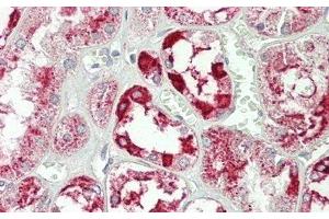 Detection of ANXA4 in Human Kidney Tissue using Polyclonal Antibody to Annexin A4 (ANXA4) (Annexin IV 抗体  (AA 165-260))