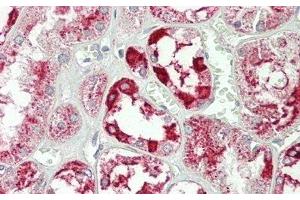 Detection of ANXA4 in Human Kidney Tissue using Polyclonal Antibody to Annexin A4 (ANXA4)