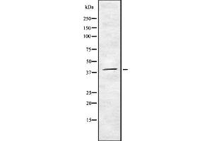 Western blot analysis U12 using HepG2 whole cell lysates (RNU12-2P 抗体)