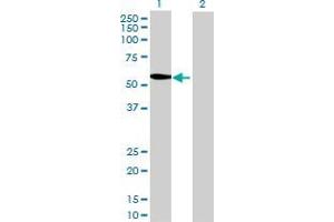 Lane 1: METTL4 transfected lysate ( 52. (METTL4 293T Cell Transient Overexpression Lysate(Denatured))