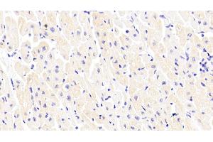 Detection of PAM in Human Cardiac Muscle Tissue using Polyclonal Antibody to Peptidylglycine Alpha Amidating Monooxygenase (PAM) (PAM 抗体  (AA 21-288))