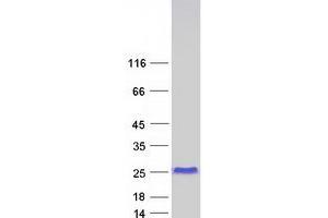 Western Blotting (WB) image for Four and A Half LIM Domains 1 (FHL1) (Transcript Variant 6) protein (Myc-DYKDDDDK Tag) (ABIN2721134)