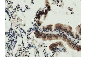 Immunohistochemistry (IHC) image for anti-DnaJ (Hsp40) Homolog, Subfamily A, Member 2 (DNAJA2) antibody (ABIN1497861) (DNAJA2 抗体)