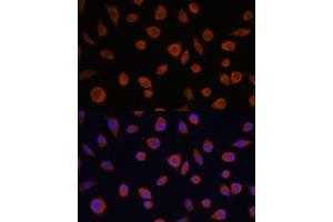 Immunofluorescence analysis of L929 cells using ZCCHC3 antibody (ABIN7271543) at dilution of 1:100. (ZCCHC3 抗体  (AA 215-335))
