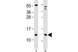 Western blot testing of human 1) human brain and 2) LNCaP cell lysate with C18orf32 antibody at 1:2000. (C18orf32 抗体  (AA 26-58))