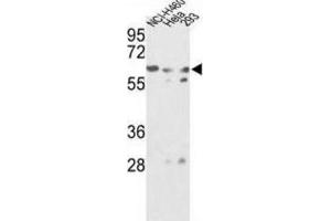 Western Blotting (WB) image for anti-Glucosamine (N-Acetyl)-6-Sulfatase (GNS) antibody (ABIN3002692) (GNS 抗体)