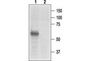 Western blot analysis of rat DRG lysates: - 1. (P2X3 Receptor (AA 383-397), (C-Term), (Intracellular) 抗体)