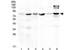 Western blot testing of 1) rat liver, 2) mouse liver, 3) mouse heart, 4) mouse testis, 5) human MCF7 and 6) human HeLa lysate at 0. (HSD17B4 抗体)