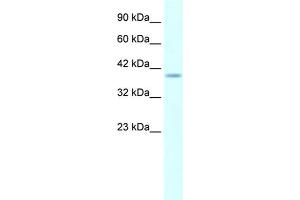 Human Daudi; WB Suggested Anti-HMX1 AntibodyTitration: 5. (HMX1 抗体  (Middle Region))