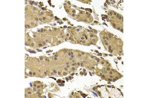 Immunofluorescence analysis of MCF7 cell using SETD5 antibody. (SETD5 抗体)