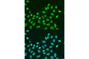 Immunofluorescence analysis of U2OS cells using CBX5 antibody. (CBX5 抗体  (AA 1-100))