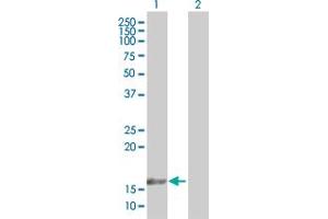 Western Blot analysis of TAF12 expression in transfected 293T cell line by TAF12 MaxPab polyclonal antibody. (TAF12 抗体  (AA 1-161))