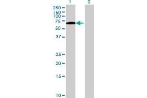 Western Blot analysis of SPINT1 expression in transfected 293T cell line by SPINT1 MaxPab polyclonal antibody. (SPINT1 抗体  (AA 1-513))