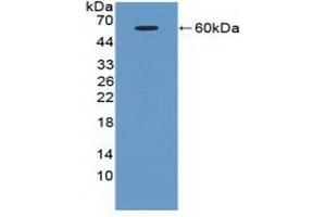 Detection of Recombinant ATM, Human using Polyclonal Antibody to Ataxia Telangiectasia Mutated (ATM) (ATM 抗体  (AA 2484-2748))