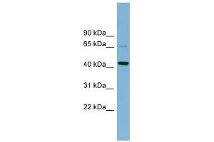 UEVLD antibody used at 1 ug/ml to detect target protein. (UEVLD 抗体  (Middle Region))