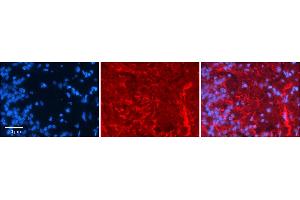 Rabbit Anti-GRIK5 Antibody     Formalin Fixed Paraffin Embedded Tissue: Human Pineal Tissue  Observed Staining: Membrane in cell processes  Primary Antibody Concentration: 1:100  Other Working Concentrations: 1/600  Secondary Antibody: Donkey anti-Rabbit-Cy3  Secondary Antibody Concentration: 1:200  Magnification: 20X  Exposure Time: 0.