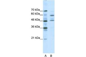 Human Jurkat; WB Suggested Anti-TFCP2L1 Antibody Titration: 0. (TFCP2L1 抗体  (Middle Region))