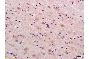 Formalin-fixed and paraffin embedded rat brain labeled with Rabbit Anti phospho-LRP1(Ser4523) Polyclonal Antibody, Unconjugated (ABIN801648) at 1:200 followed by conjugation to the secondary antibody and DAB staining (LRP1 抗体  (pSer4523))