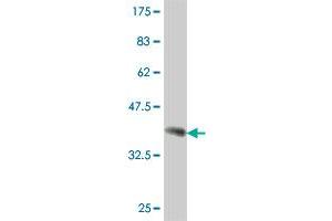 Western Blot detection against Immunogen (37. (SNAP91 抗体  (AA 156-255))