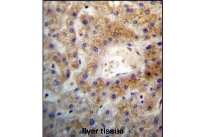 SGEF Antibody (Center) (ABIN657248 and ABIN2846346) immunohistochemistry analysis in formalin fixed and paraffin embedded human liver tissue followed by peroxidase conjugation of the secondary antibody and DAB staining. (SGEF 抗体  (AA 378-406))