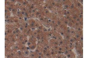 Immunohistochemistry (IHC) image for anti-Collagen, Type I, alpha 1 (COL1A1) (AA 253-471) antibody (ABIN7443395)