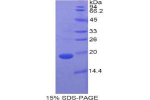 SDS-PAGE analysis of Pig RBP7 Protein. (RBP7 蛋白)