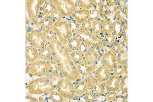Immunohistochemistry of paraffin-embedded mouse kidney using MOCS3 antibody at dilution of 1:100 (x400 lens). (MOCS3 抗体)