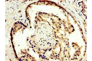Immunohistochemistry (IHC) image for anti-Nuclear Receptor Subfamily 2, Group E, Member 3 (NR2E3) (AA 112-222) antibody (ABIN7163426)