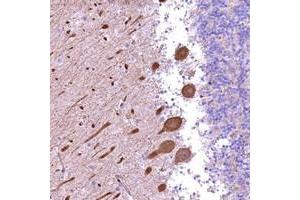 Immunohistochemical staining of human cerebellum with FUZ polyclonal antibody  shows strong cytoplasmic positivity in purkinje cells. (FUZ 抗体)