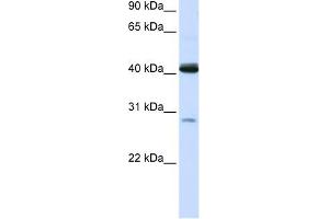 GCDH antibody used at 1 ug/ml to detect target protein. (GCDH 抗体  (N-Term))