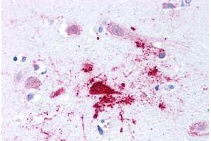 Human Brain, Alzheimers (formalin-fixed, paraffin-embedded) stained with BACE1 antibody ABIN213580 at 2. (BACE1 抗体  (N-Term))
