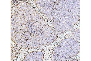 IHC analysis of ARL6IP6 using anti-ARL6IP6 antibody (ABIN7603020). (ARL6IP6 抗体  (Middle Region))