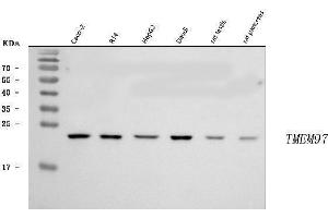 anti-Transmembrane Protein 97 (TMEM97) (AA 5-141) antibody