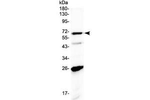 Western blot testing of human A431 cell lysate with SLC7A3 antibody at 0.